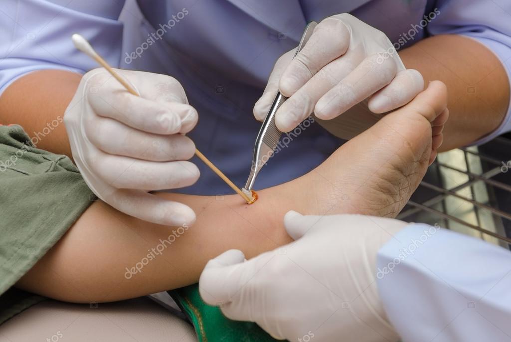 Chirurgo ortopedico pediatrico in sala operatoria per intervento al piede